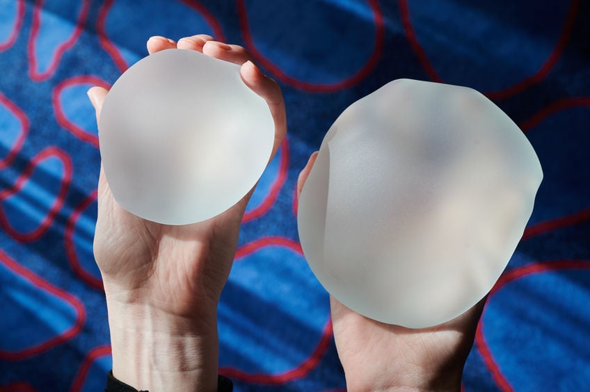 john-park-plastic-surgery-Is-It-Time-For-Breast-Implant-Exchange-Benefits-Of-Silicone-vs-Saline.