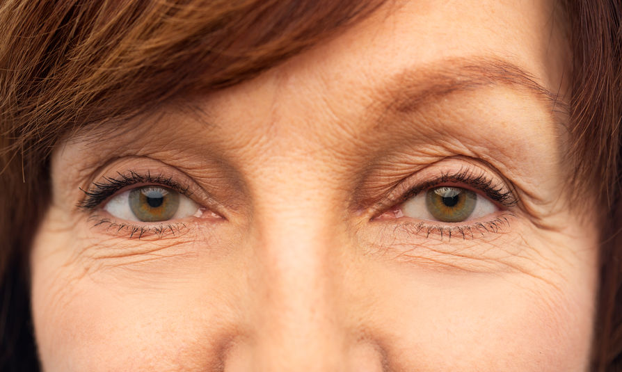 john-park-plastic-surgery-Eyelid-Surgery-Options-Upper_-Lower-Or-Both-Choosing-The-Right-Procedure