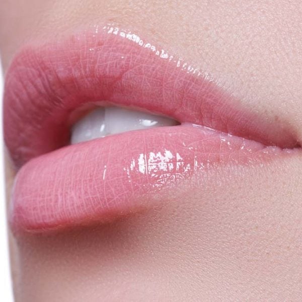 Dermal Fillers Orange County, CA | John Park MD Plastic Surgery Dermal Fillers Orange County, CA | John Park MD Plastic Surgery