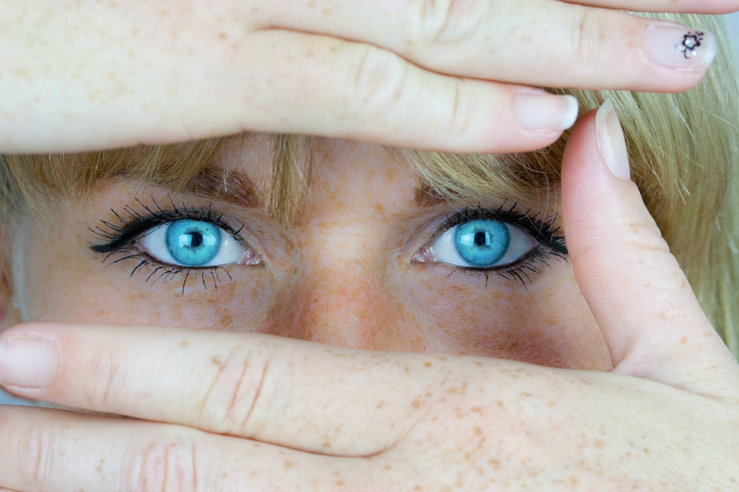 john park plastic surgery Blepharoplasty Rejuvenate Your Eyes To Unleash Your Natural Beauty