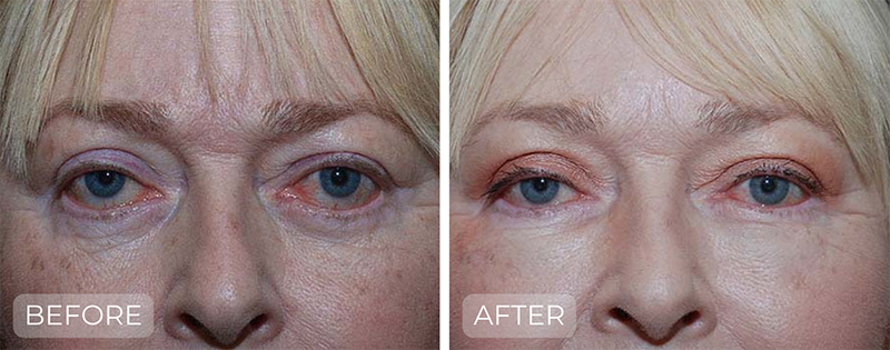 Dr. John Park MD: Non-Surgical | Patient 1 - Thumbnail & Dedicated Page