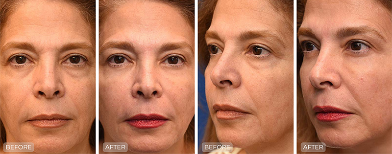 Dr. John Park MD: Non-Surgical | Patient 2 - Thumbnail & Dedicated Page