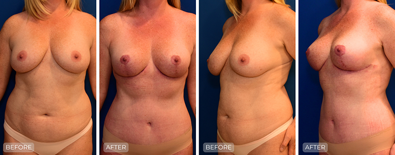 Dr. John Park MD: Body | Patient 1 - Thumbnail