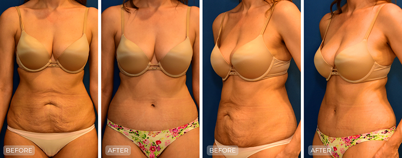 Dr. John Park MD: Body | Patient 10 - Thumbnail