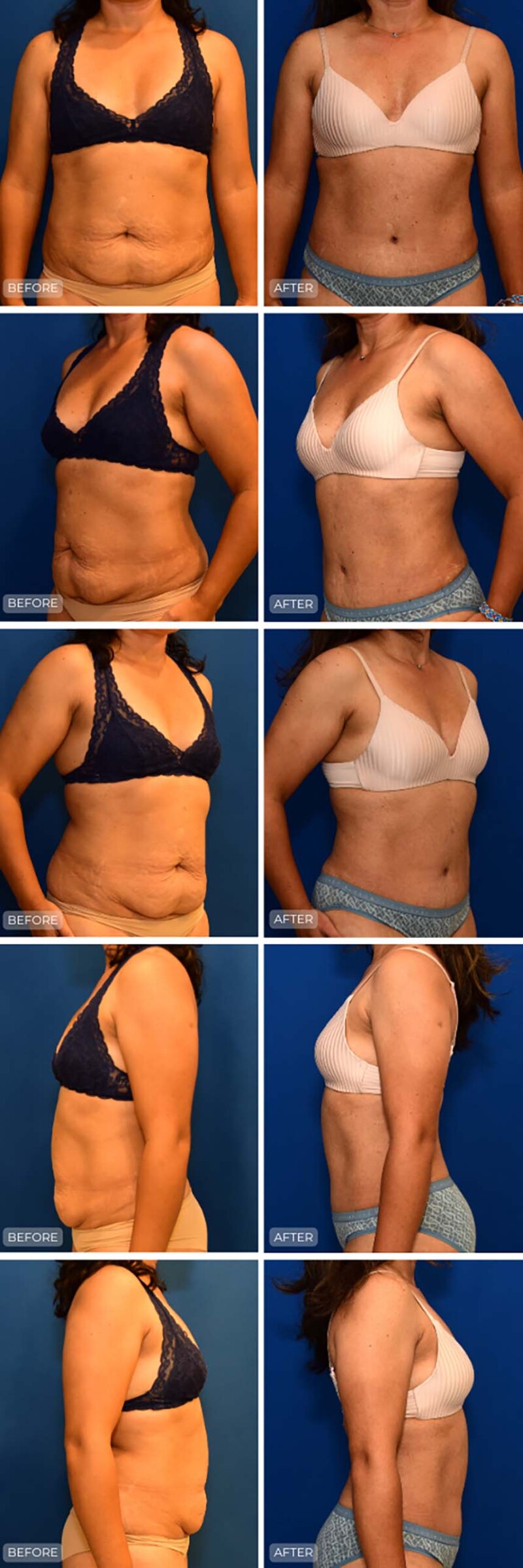 Dr. John Park MD: Body | Patient 11 - Dedicated Page