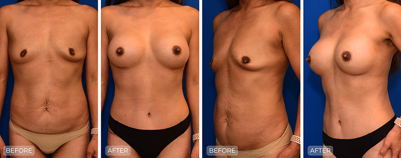 Dr. John Park MD: Body | Patient 3 - Thumbnail