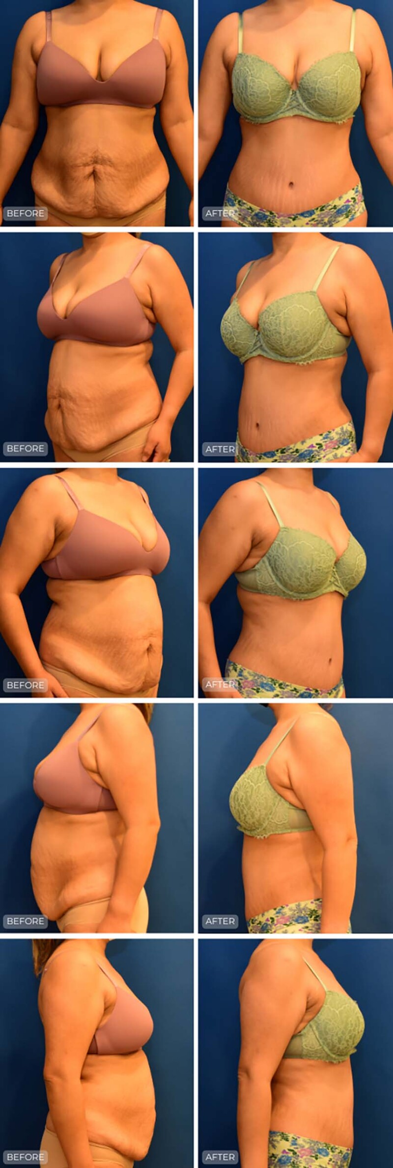 Dr. John Park MD: Body | Patient 4 - Dedicated Page