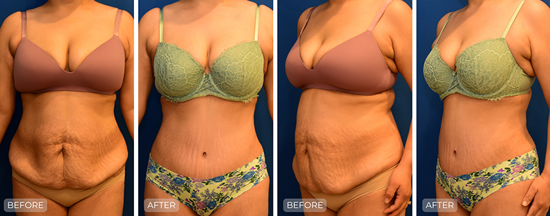 Dr. John Park MD: Body | Patient 4 - Thumbnail