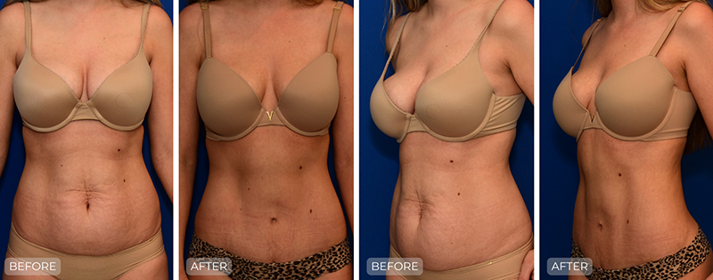 Dr. John Park MD: Body | Patient 6 - Thumbnail