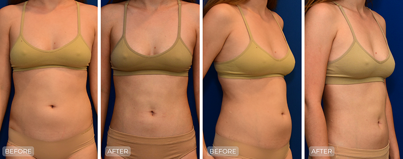 Dr. John Park MD: Body | Patient 8 - Thumbnail