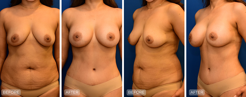 Dr. John Park MD: Body | Patient 9 - Thumbnail