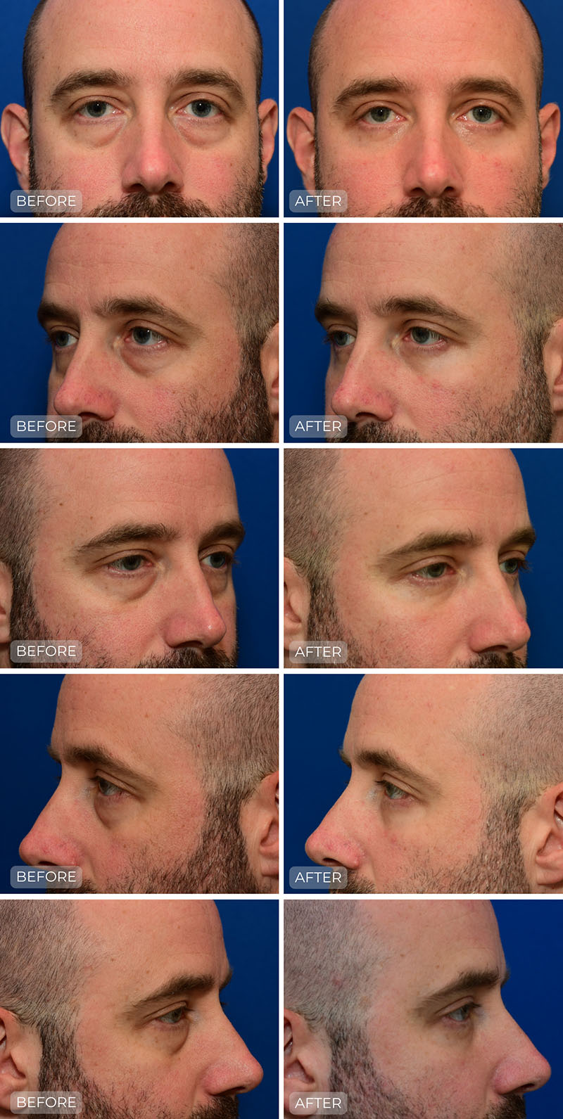 Dr. John Park MD: Face / Eyelids | Patient 1 - Dedicated Page