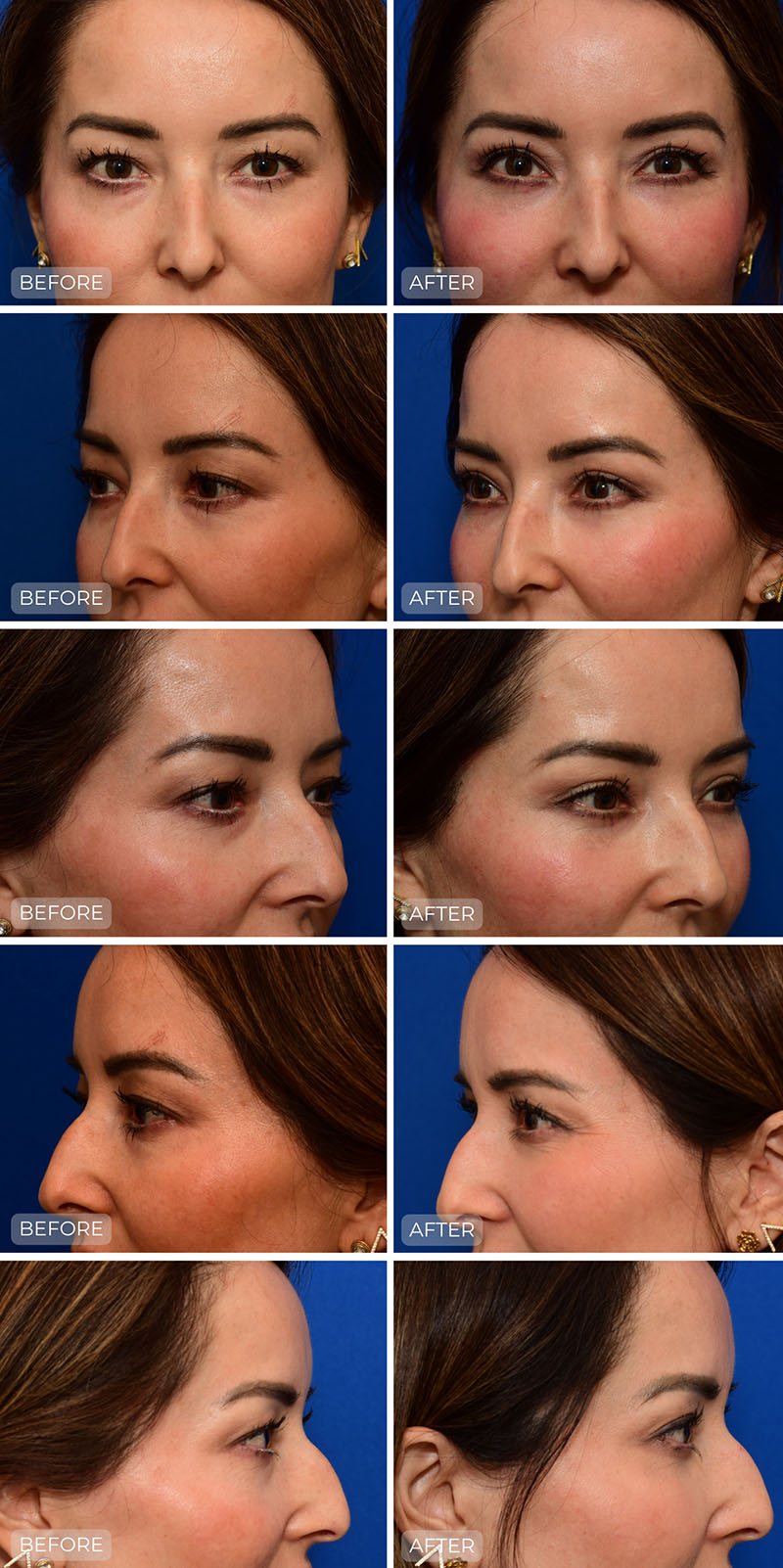 Dr. John Park MD: Face / Eyelids | Patient 14 - Dedicated Page