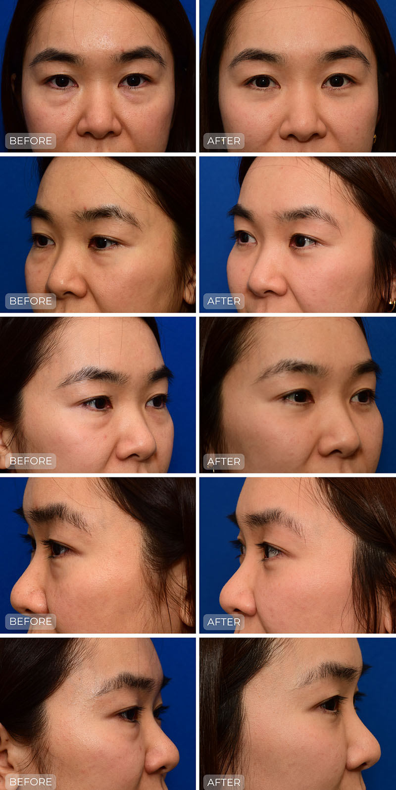 Dr. John Park MD: Face / Eyelids | Patient 6 - Dedicated Page