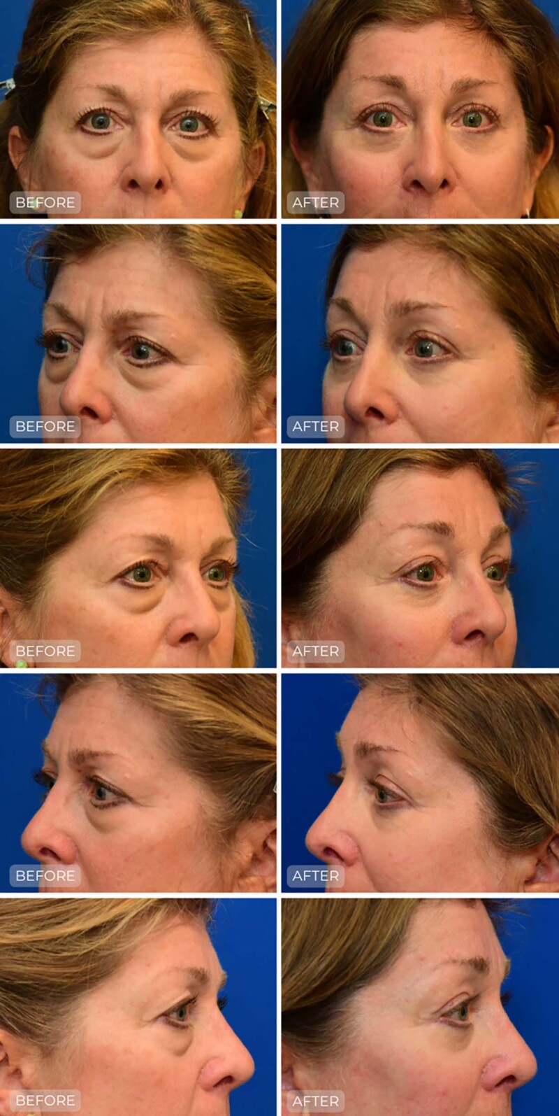 Dr. John Park MD: Face / Eyelids | Patient 7 - Dedicated Page