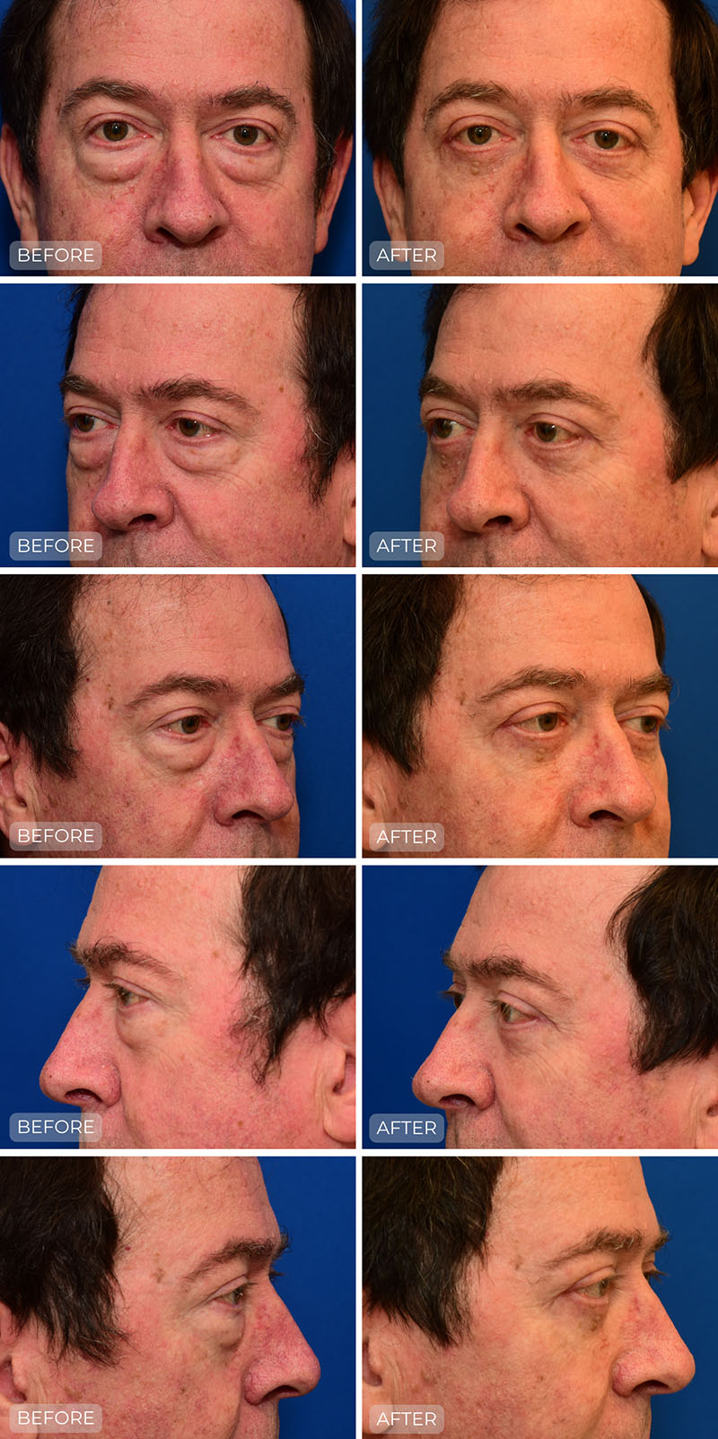 Dr. John Park MD: Face / Eyelids | Patient 9 - Dedicated Page