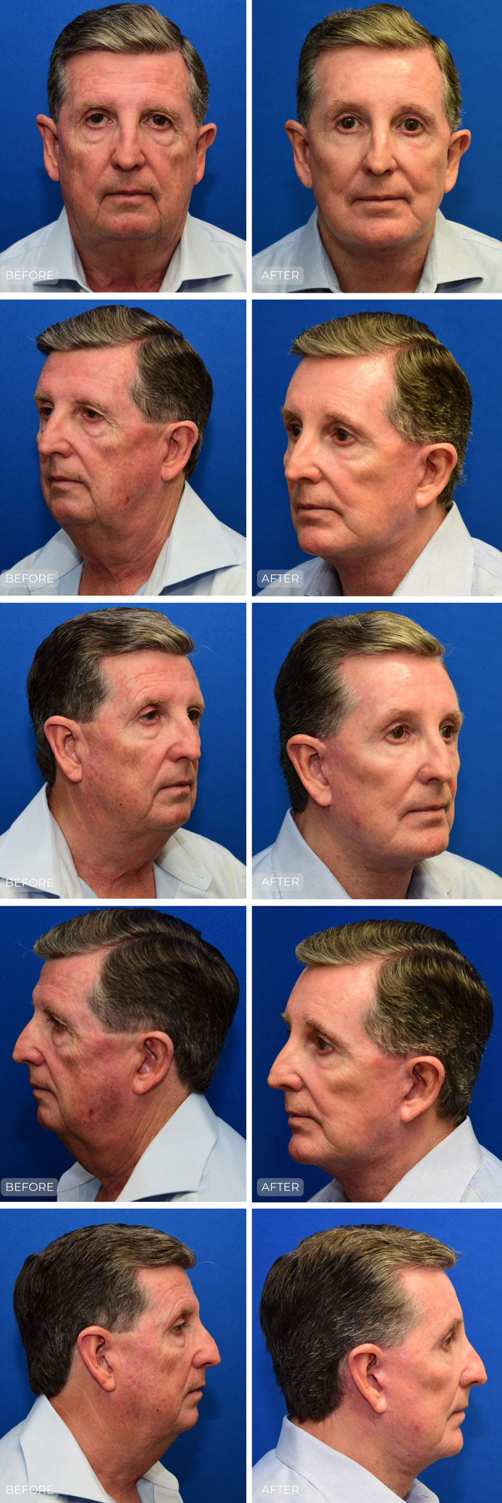 Dr. John Park MD: Face / Eyelids | Patient 24 - Dedicated Page