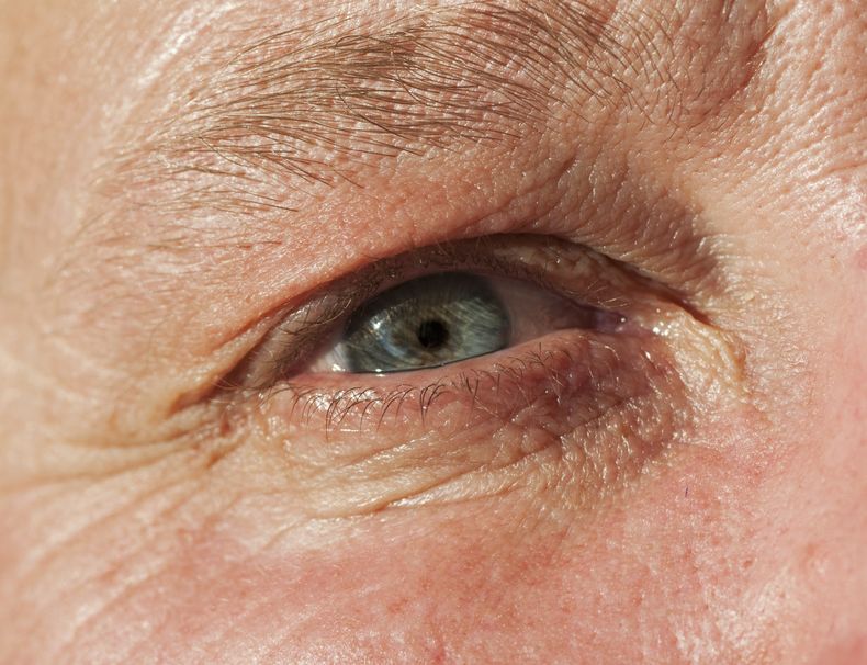 john-park-plastic-surgery-Should-You-Get-Blepharoplasty-Learn-More-About-Eyelid-Aging